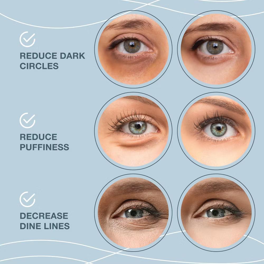 Under Eye Patches for Puffy Eyes and Dark Circles – 24k Gold Under Eye Masks Patch for Puffiness, 20 Pairs Gold Under Eye Mask Patches for Puffy Eyes - Image 6