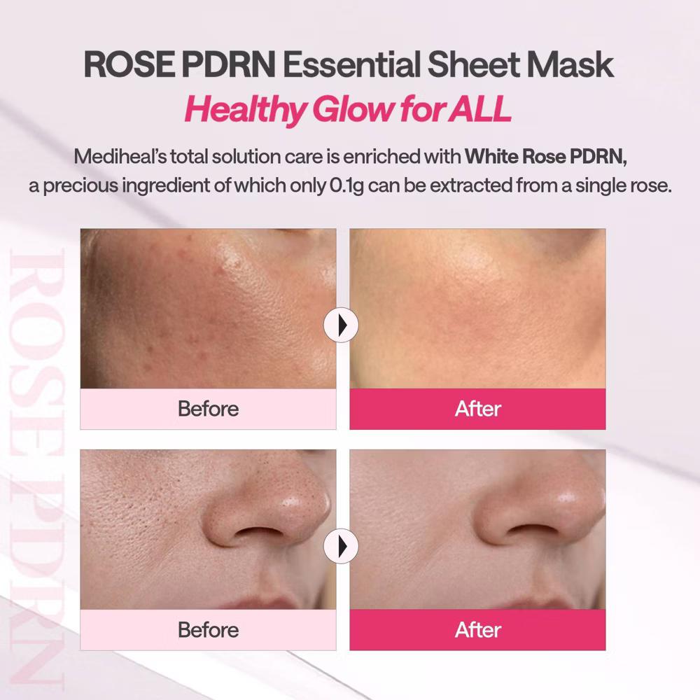 MEDIHEAL Essential Mask - Rose PDRN - 0.81 fl oz - Image 4