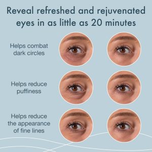 24k Gold Under Eye Patches for Puffy Eyes and Dark Circles, Under Eye Mask Patches for Puffiness, Under Eye Masks 60 Pairs Gold for Puffy Eyes