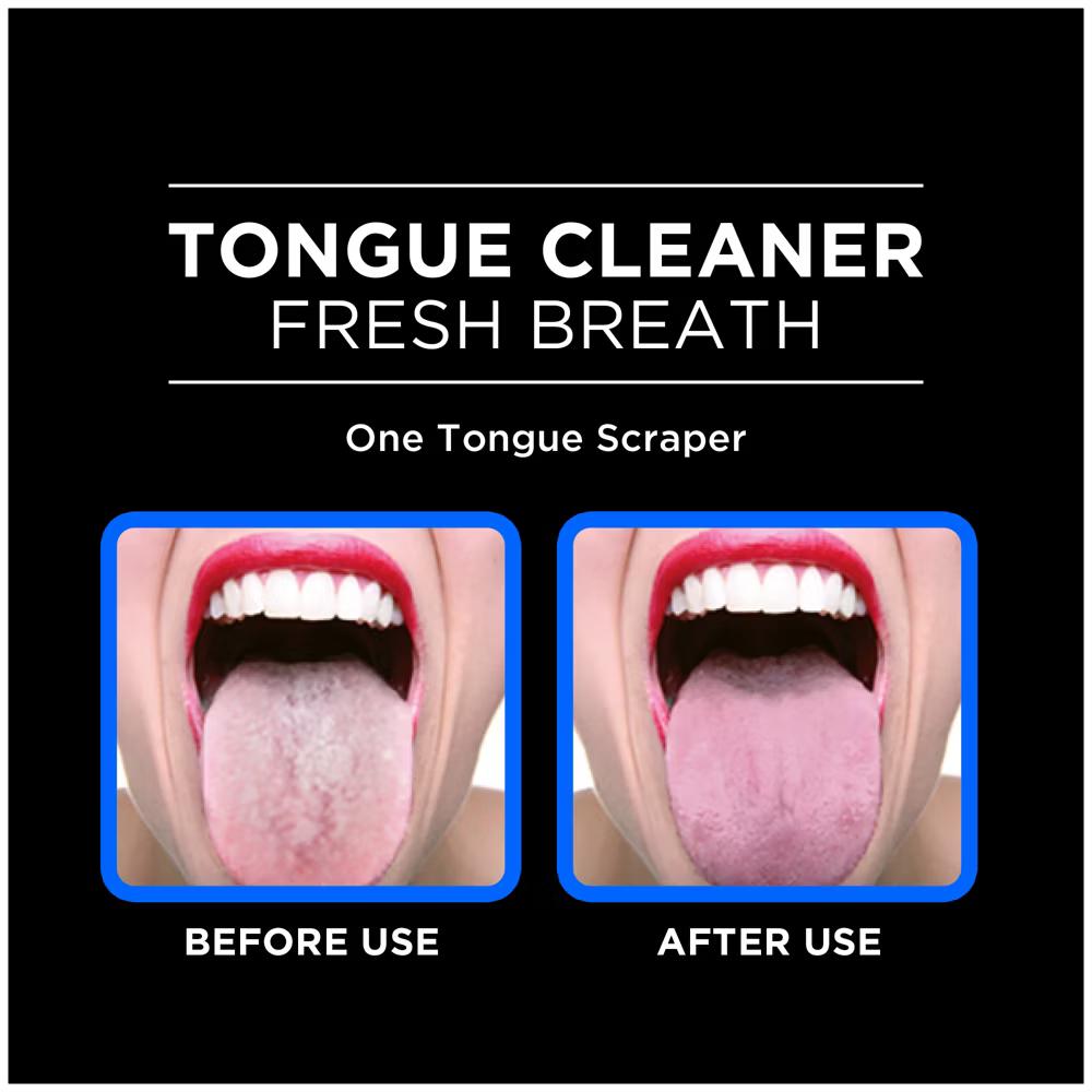 Orabrush Tongue Cleaner - Image 2