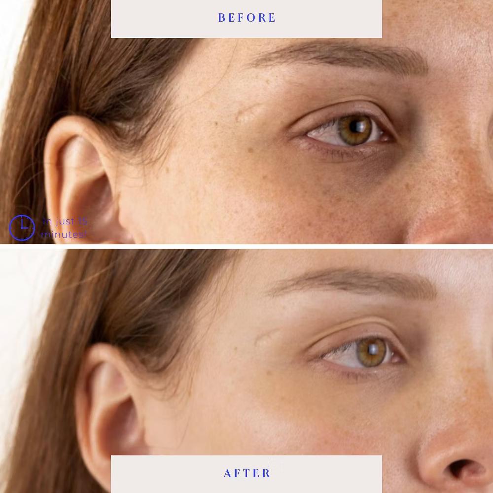 BioRepublic SkinCare Lost Baggage Under Eye Masks - 3pk: Moisturizing, Deep Hydration, Contains Hyaluronic Acid, Sensitive Skin