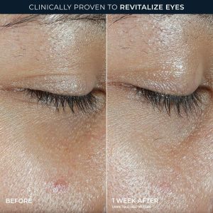 RoC Multi Correxion Revive and Glow Vitamin C Under Eye Balm - 0.14oz: Stick Form, Hypoallergenic, No Fragrance
