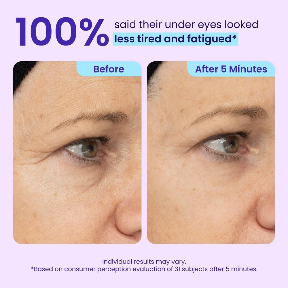 goPure Instant Eye Lift Gel - 0.34oz - Image 11